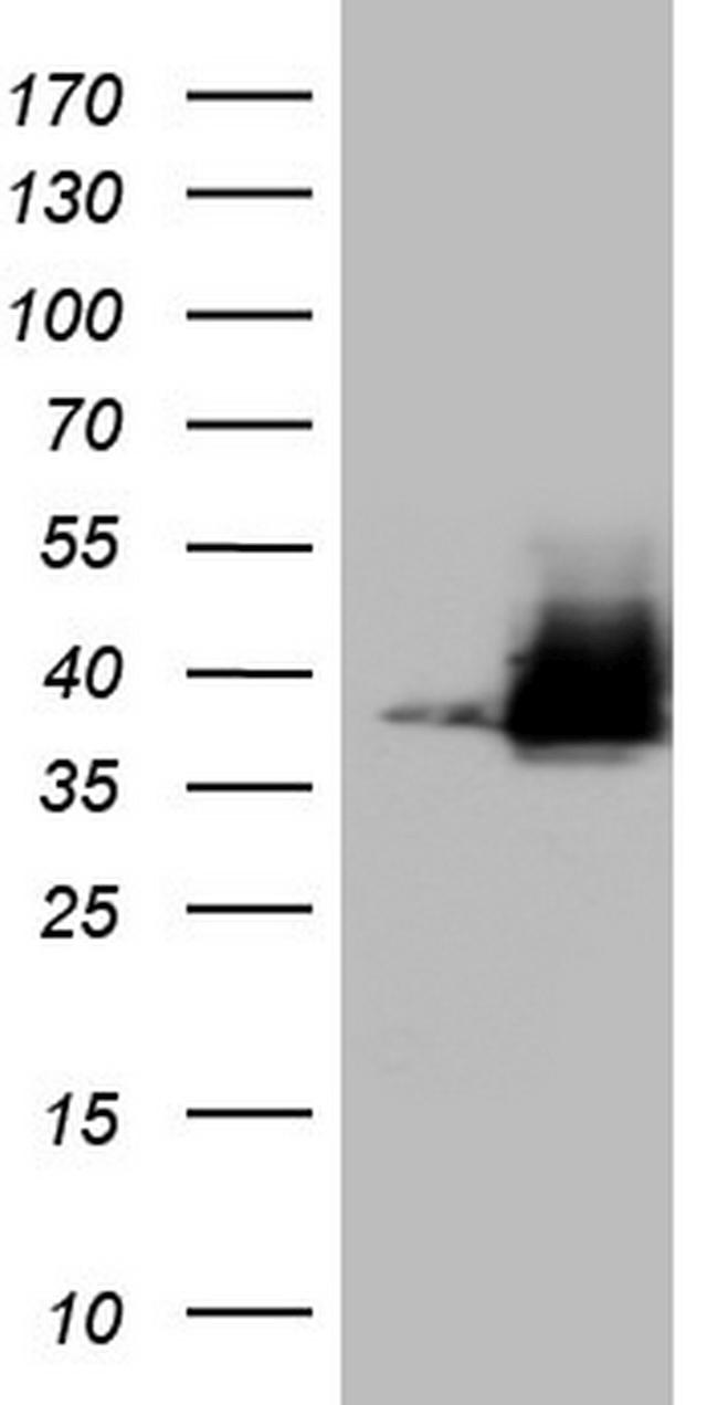 Nkx3.1 Antibody in Western Blot (WB)