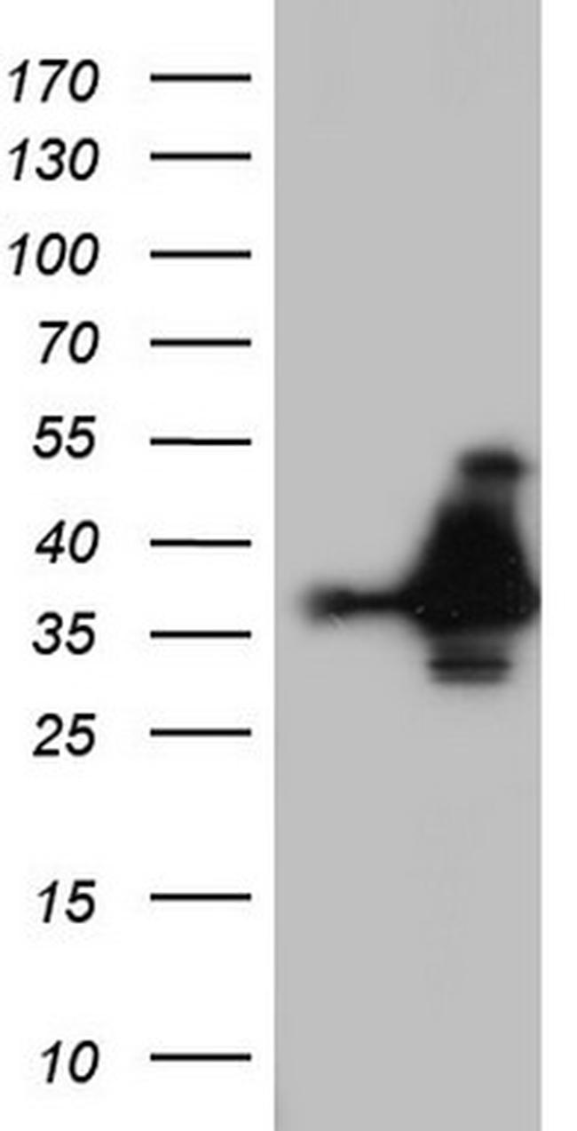 NKX3.1 Antibody in Western Blot (WB)