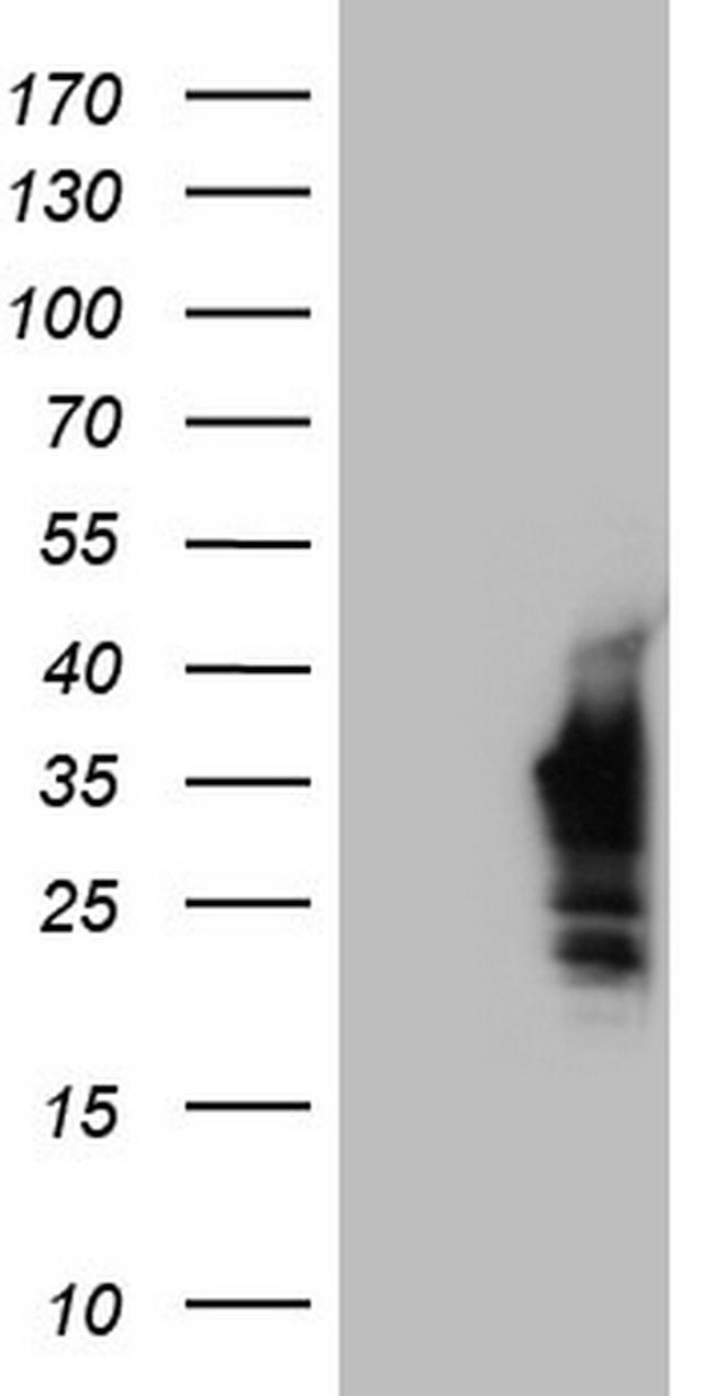 Nkx3.1 Antibody in Western Blot (WB)