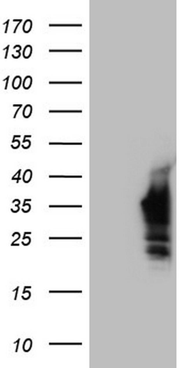 NKX3.1 Antibody in Western Blot (WB)