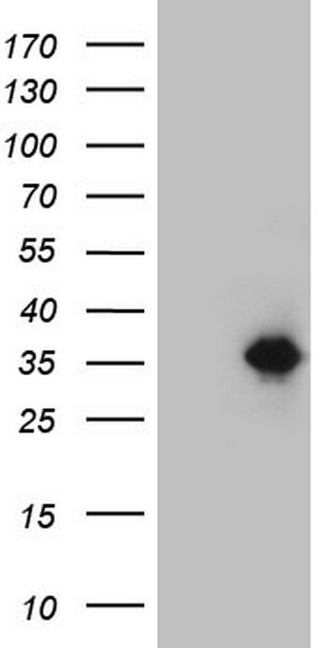 NKX3.1 Antibody in Western Blot (WB)