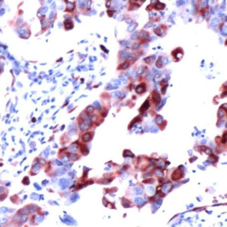 S6 Antibody in Immunohistochemistry (IHC)