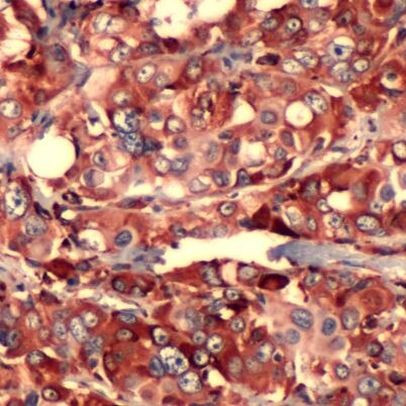 S6 Antibody in Immunohistochemistry (IHC)