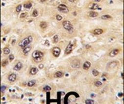 Nucleostemin Antibody in Immunohistochemistry (IHC)