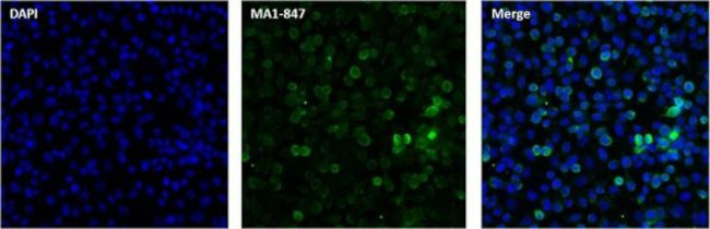 RANBP2 Antibody in Immunocytochemistry (ICC/IF)