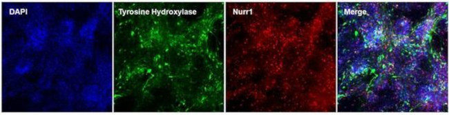 Nurr1 Antibody in Immunocytochemistry (ICC/IF)