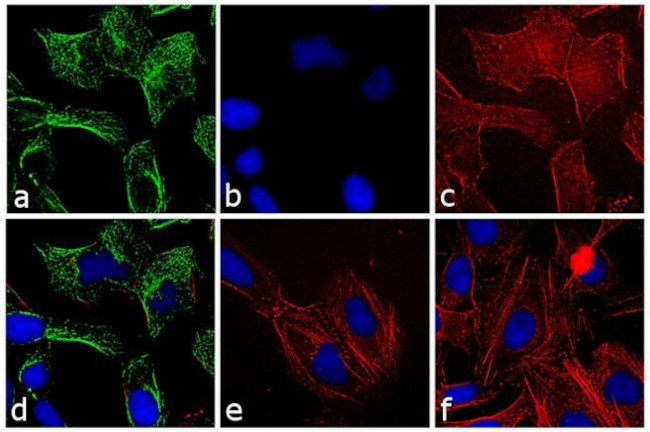 Rabbit IgG (H+L) Secondary Antibody in Immunocytochemistry (ICC/IF)