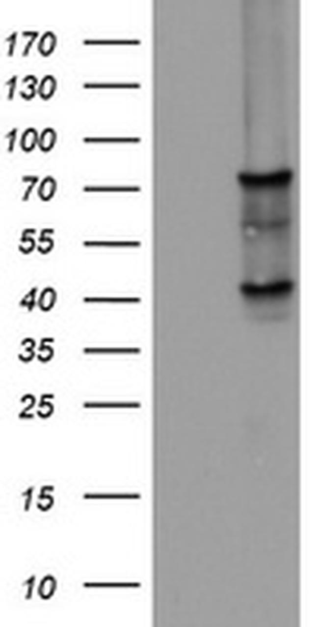 OAS2 Antibody in Western Blot (WB)
