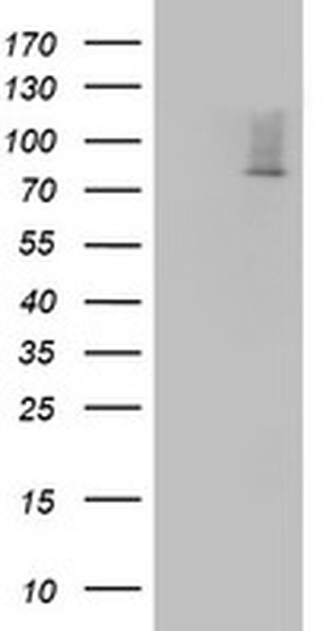 OAS2 Antibody in Western Blot (WB)