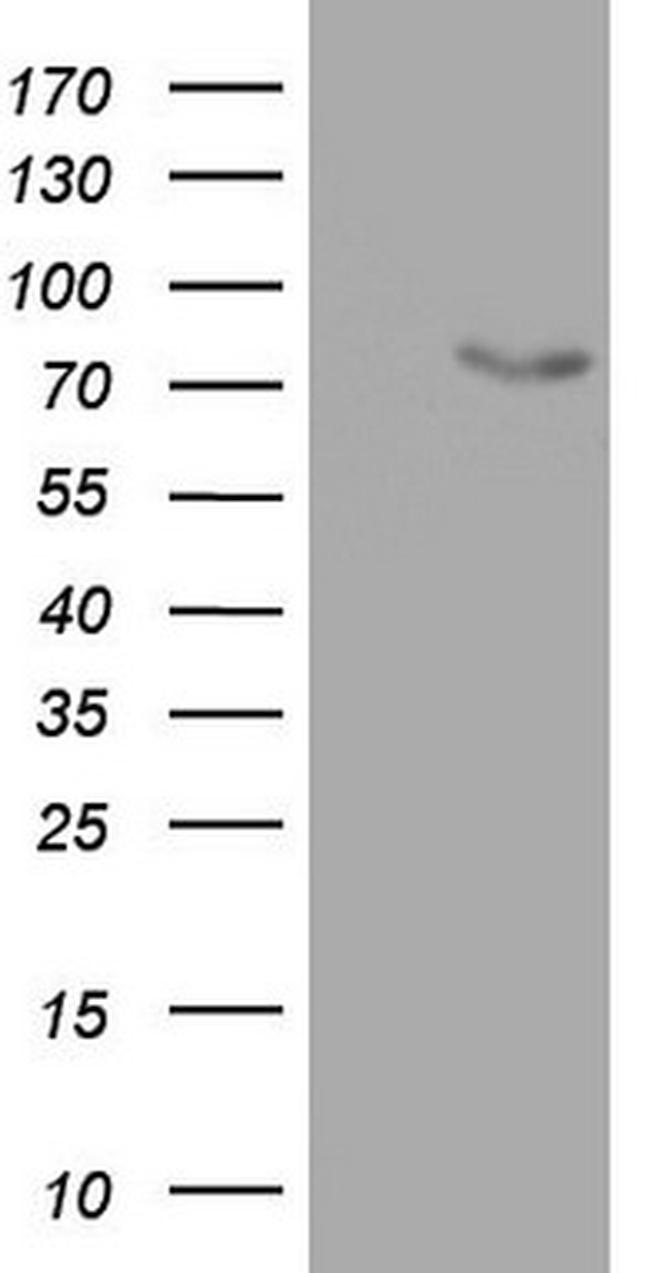 OAS2 Antibody in Western Blot (WB)