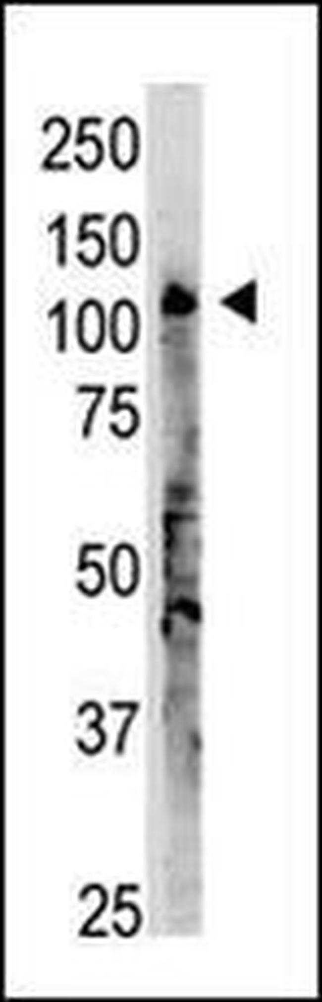 OAS3 Antibody in Western Blot (WB)