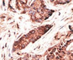 OASL Antibody in Immunohistochemistry (IHC)