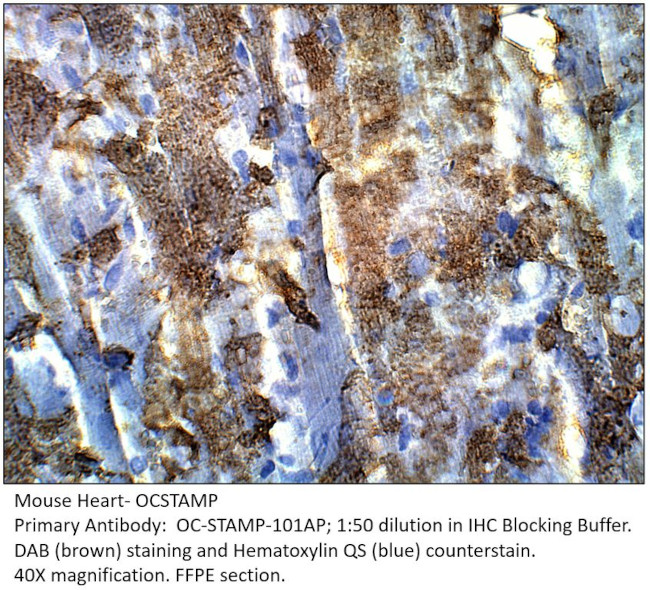 OCSTAMP Antibody in Immunohistochemistry (IHC)