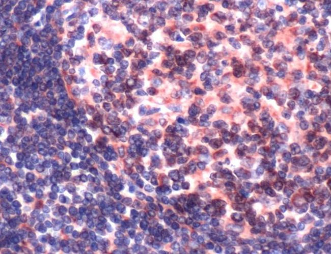 OCT1 (POU2F1) Antibody in Immunohistochemistry (IHC)