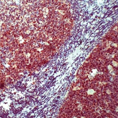 Oct-2 Antibody in Immunohistochemistry (IHC)