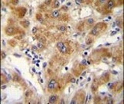 ODF3B Antibody in Immunohistochemistry (IHC)