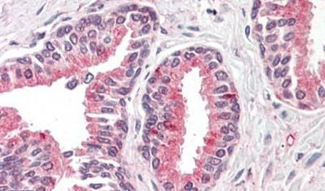 OLFM4 Antibody in Immunohistochemistry (Paraffin) (IHC (P))