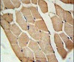OLFML2A Antibody in Immunohistochemistry (IHC)