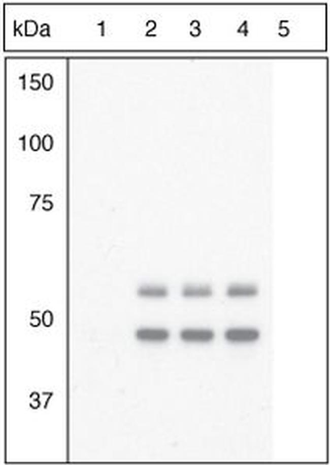 Phospho-GSK3 alpha/beta (Tyr279, Tyr216) Antibody in Western Blot (WB)