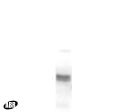 GABRG2 Antibody in Western Blot (WB)