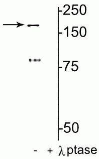 Phospho-NMDAR2B (Tyr1472) Antibody in Western Blot (WB)