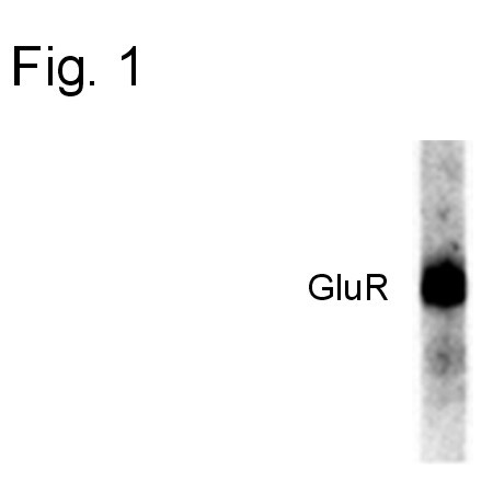 Phospho-GluR1 (Ser831) Antibody in Western Blot (WB)