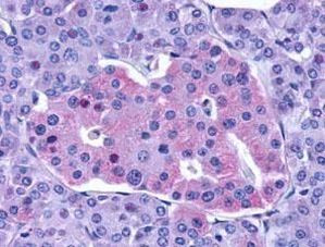 GLP1R Antibody in Immunohistochemistry (IHC)