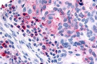 HRH4 Antibody in Immunohistochemistry (Paraffin) (IHC (P))