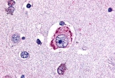 MC4R Antibody in Immunohistochemistry (Paraffin) (IHC (P))