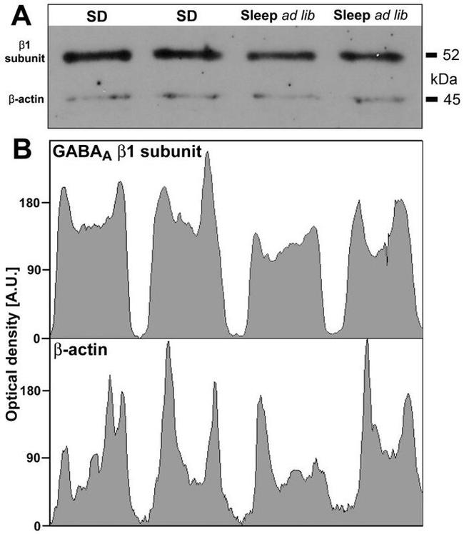 GABRB1 Antibody in Western Blot (WB)