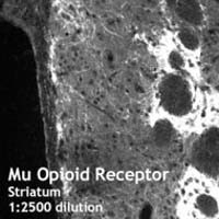 OPRM1 Antibody in Immunohistochemistry (IHC)