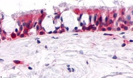 OR2A4 Antibody in Immunohistochemistry (Paraffin) (IHC (P))