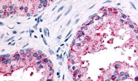 PSGR Antibody in Immunohistochemistry (Paraffin) (IHC (P))
