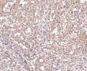 ORAI1 Antibody in Immunohistochemistry (Paraffin) (IHC (P))