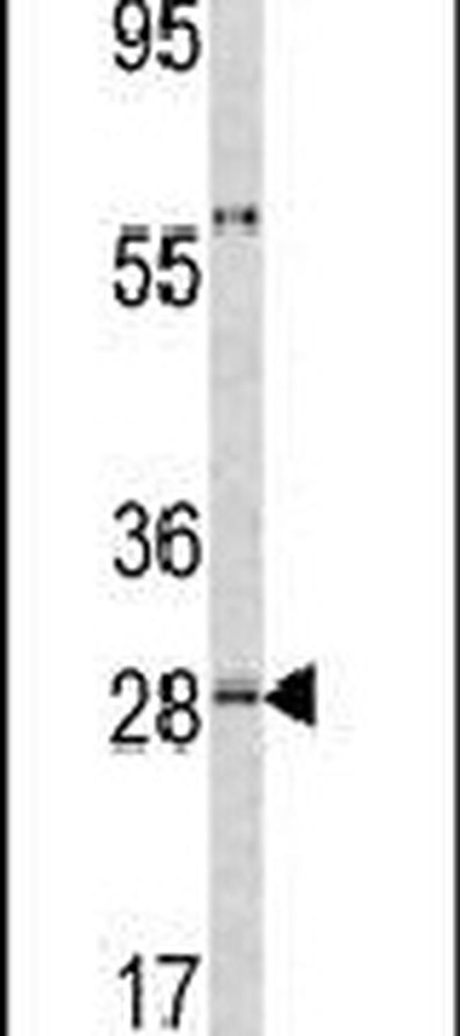ORM1 Antibody in Western Blot (WB)