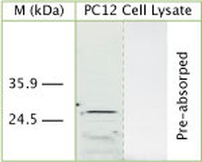 DRAM Antibody in Western Blot (WB)