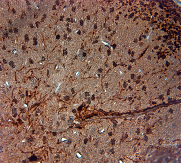 AQP1 Antibody in Immunohistochemistry (Paraffin) (IHC (P))