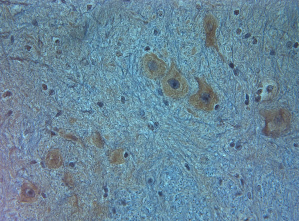 AQP11 Antibody in Immunohistochemistry (Paraffin) (IHC (P))