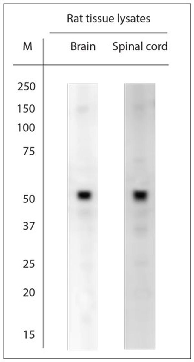 MT-ATP6 Antibody in Western Blot (WB)