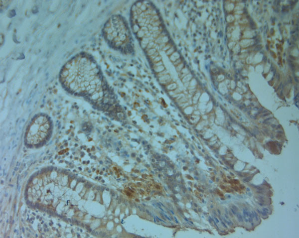 ABCC6 Antibody in Immunohistochemistry (Paraffin) (IHC (P))