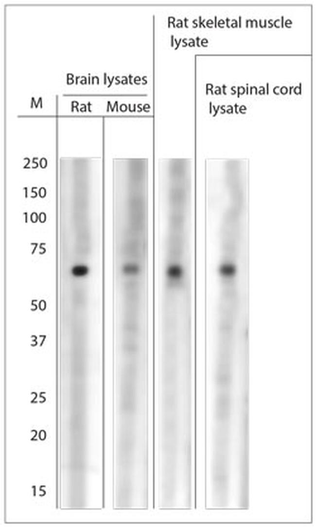 ASIC1 Antibody in Western Blot (WB)