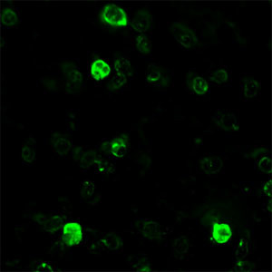 BEX1/BEX2 Antibody in Immunocytochemistry (ICC/IF)