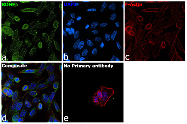 BDNF Antibody in Immunocytochemistry (ICC/IF)