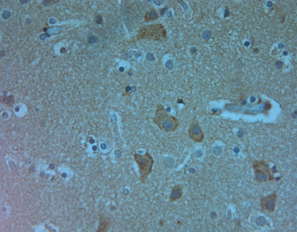 Bassoon Antibody in Immunohistochemistry (Paraffin) (IHC (P))