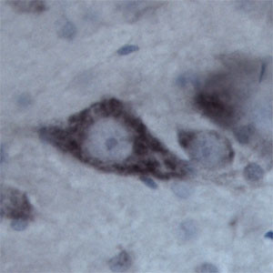 Contactin 1 Antibody in Immunohistochemistry (IHC)