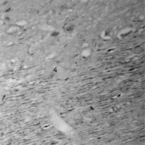 CACNA1I Antibody in Immunohistochemistry (Paraffin) (IHC (P))