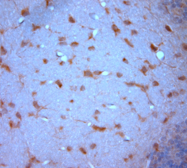 Stargazin Antibody in Immunohistochemistry (Paraffin) (IHC (P))