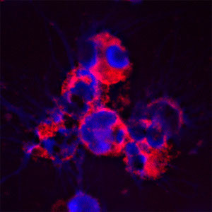 Cathelicidin Antibody in Immunocytochemistry (ICC/IF)
