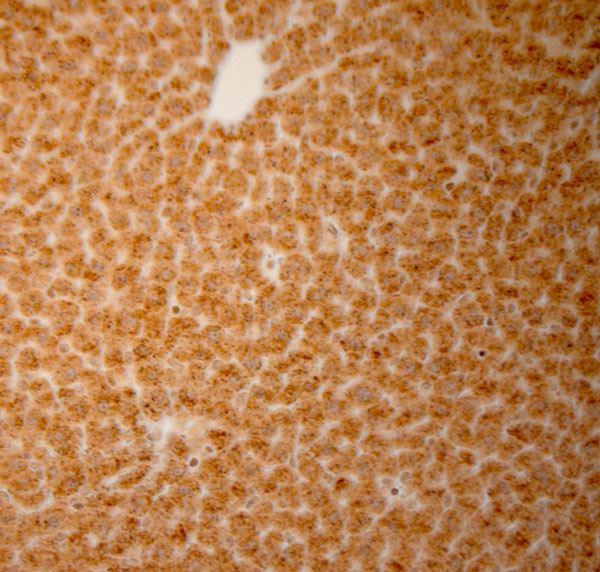 Catalase Antibody in Immunohistochemistry (Paraffin) (IHC (P))