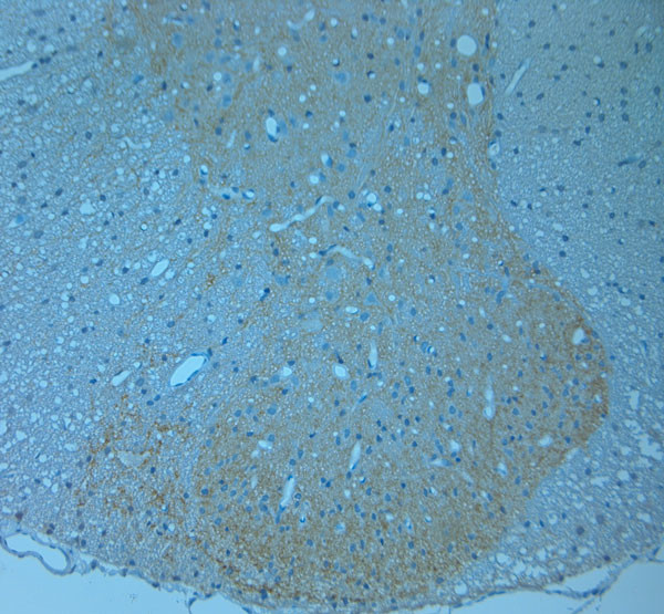CSP Antibody in Immunohistochemistry (Paraffin) (IHC (P))